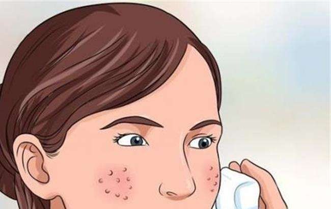 蜂王漿對(duì)痘痘有好處嗎?長痘痘可以服用蜂王漿嗎?